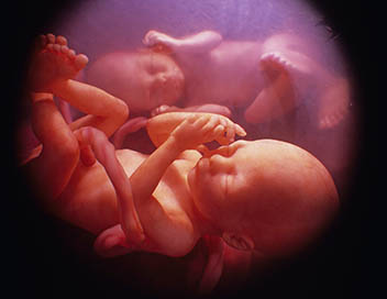 Miracles in utero